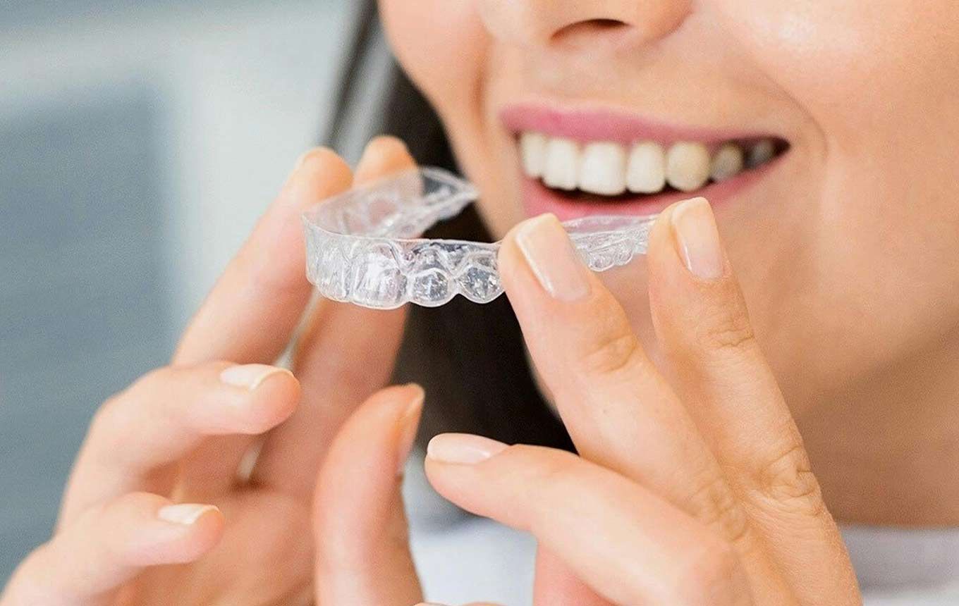Διαφανείς Νάρθηκες - Invisalign